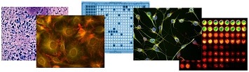 Example images of a tissue section, fluorescent cells, 384 well plate, cultured cells with fluorescent label and a 96 micro titre plate